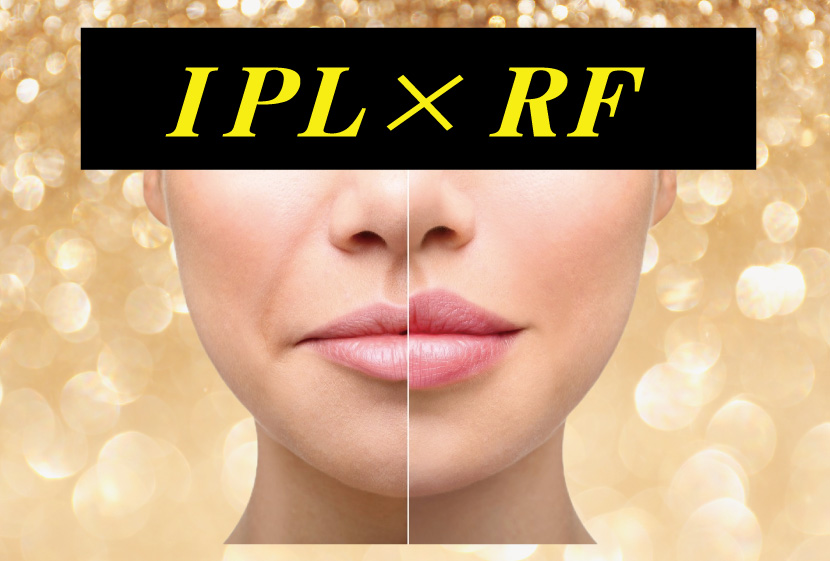 IPL×RF