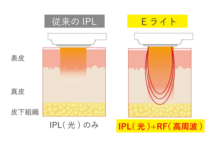 従来の光の届き方との違い