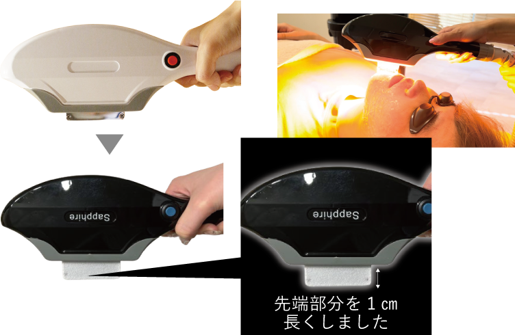 業務用脱毛機ペガサスプロプラス＆ペガサスプロネオ |お客様のご要望に 
