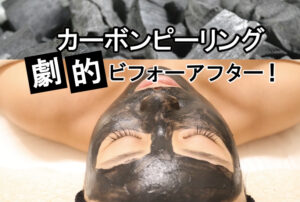 カーボンピーリングで劇的ビフォーアフター