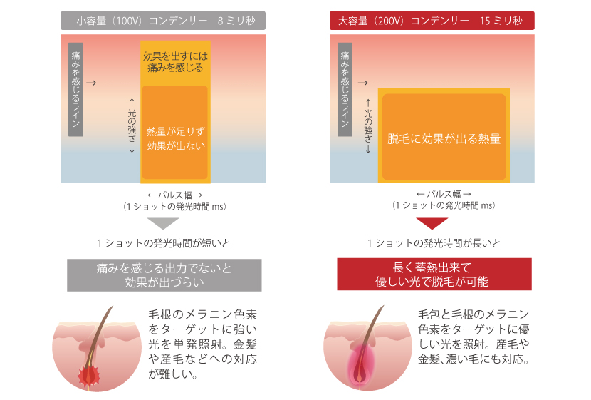 パルス幅15ミリの効果と無痛