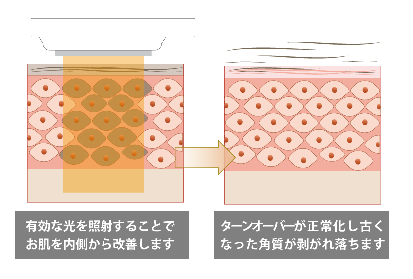 SSRの仕組み