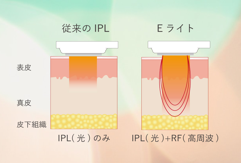 Eライトの仕組み