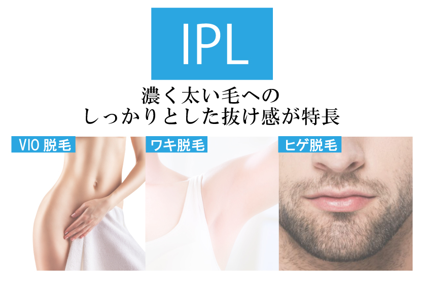 IPL脱毛の特徴