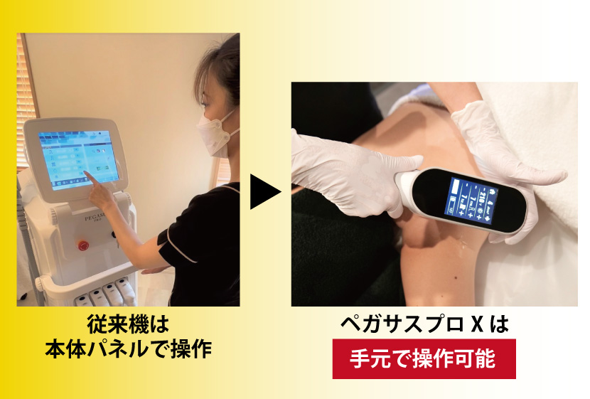 ペガサスプロXはハンドルで手元操作