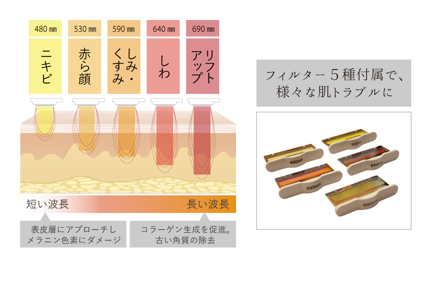 5種のフィルター