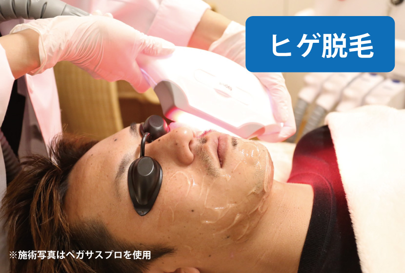ヒゲ脱毛‐ペガサスプロ