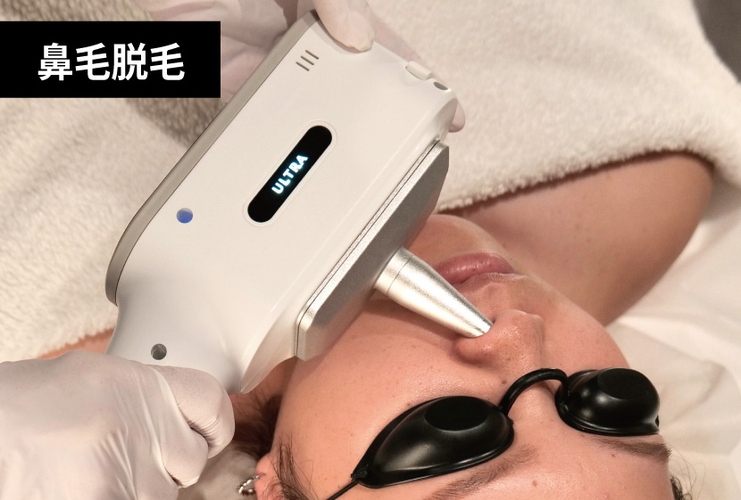 ペガサスプロXは鼻毛脱毛可能