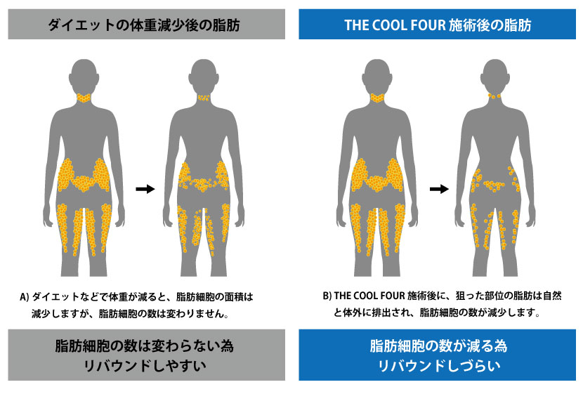 リバウンドしにくい