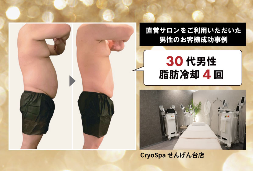直営サロンにて男性の成功事例も
